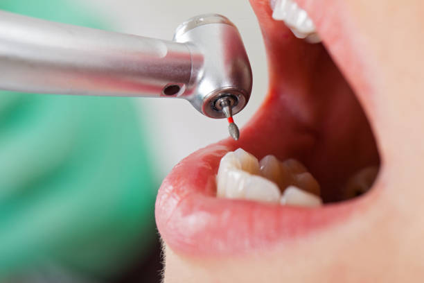 Best Broken or Chipped Tooth Repair in Sun Valley, ID